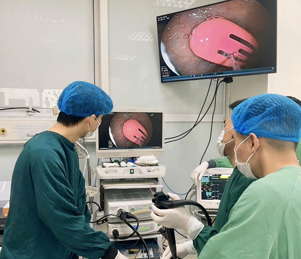 Bác sĩ tiến hành lấy dị vật