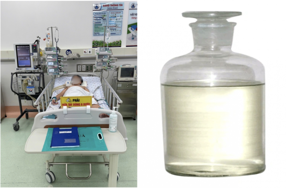 Bé trai hôn mê - suy hô hấp nặng do hít phải khí độc styrene dùng để hàn nhựa
(Ảnh Sở Y tế)