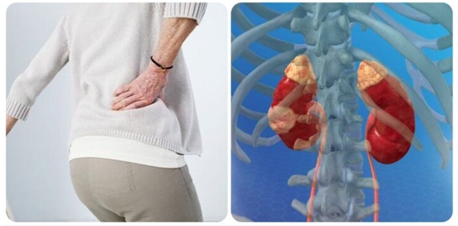 Ung thư thận là căn bệnh ung thư nguy hiểm