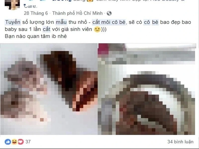 Thẩm mỹ chui “đóng mác” tuyển mẫu miễn phí, giá rẻ tràn lan trên mạng xã hội (Ảnh internet)