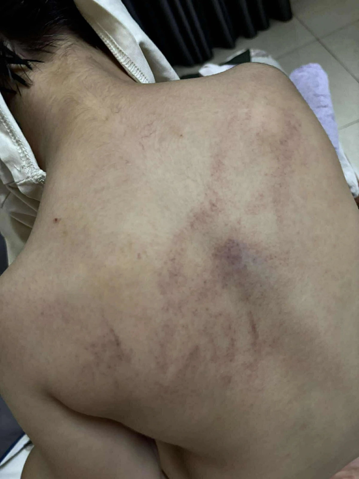 Theo gia đình thông tin, chiều nay, ngày 9/7, gia đình đã đưa cháu đang trên viện giám định pháp y TW để giám định thương tật theo chỉ định của cơ quan công an. 