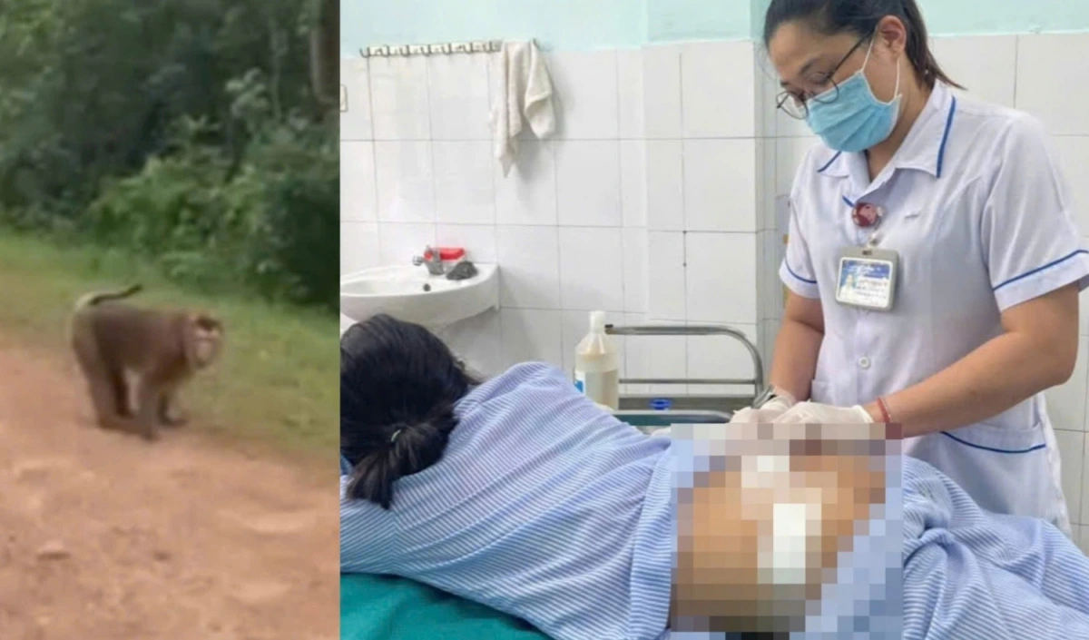 Cá thể khỉ tấn công người làm 1 cháu bé nhập viện