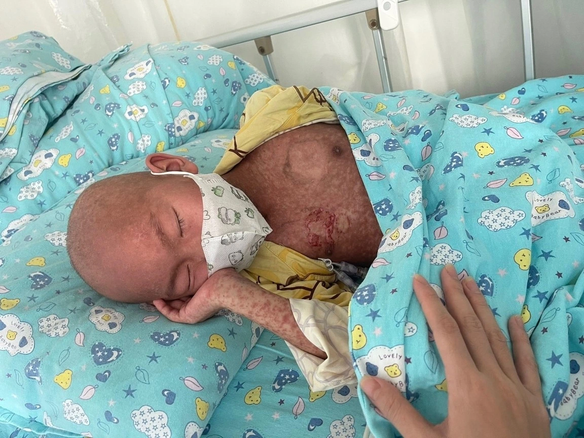 Tuổi thơ Đức Trí gắn liền với máy móc, thuốc kháng sinh và dây cắm ống truyền tại bệnh viện (Ảnh: NVCC)