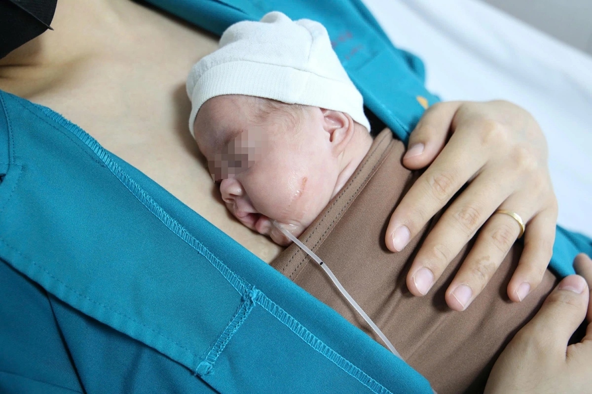 Em bé được ra ghép mẹ, thực hiện phương pháp Kangaroo (Ảnh BVCC)