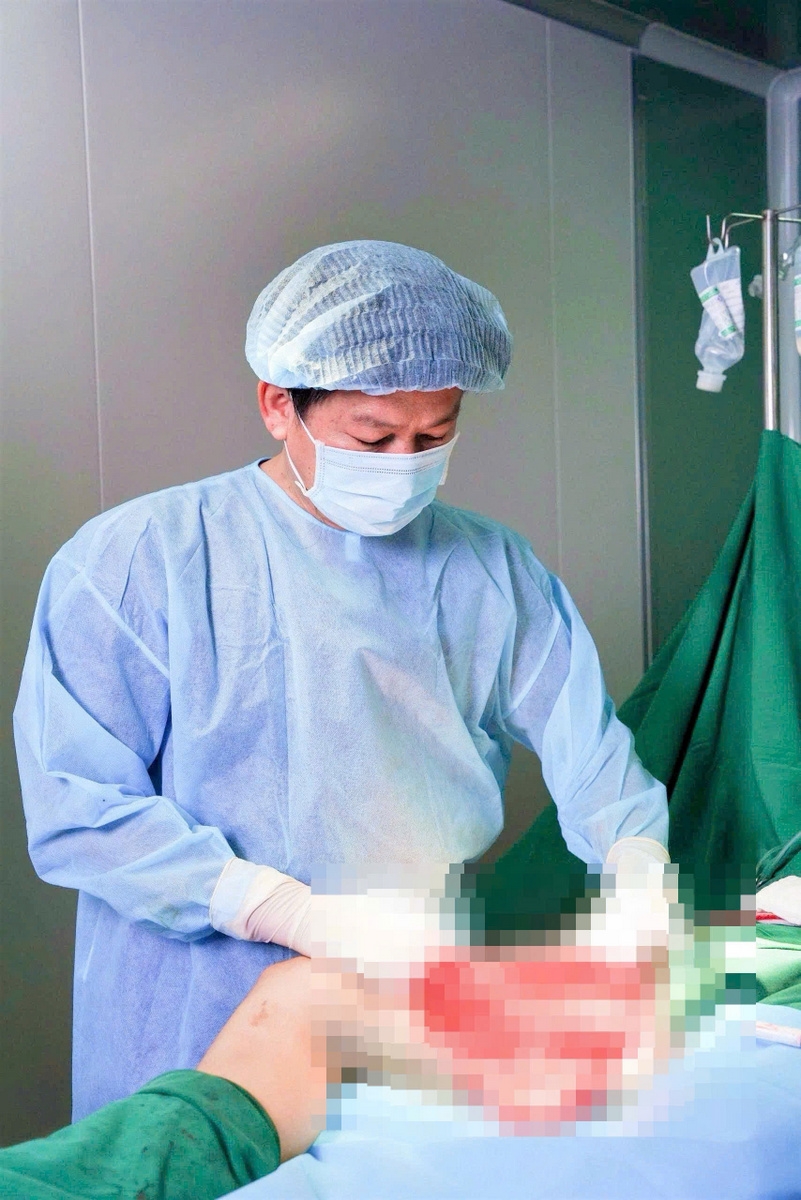 Đùi bệnh nhân bị hoại tử nghiêm trọng, bác sĩ phải rạch, bóc tách mô hoại tử trong 5 giờ đồng hồ (Ảnh BVCC).