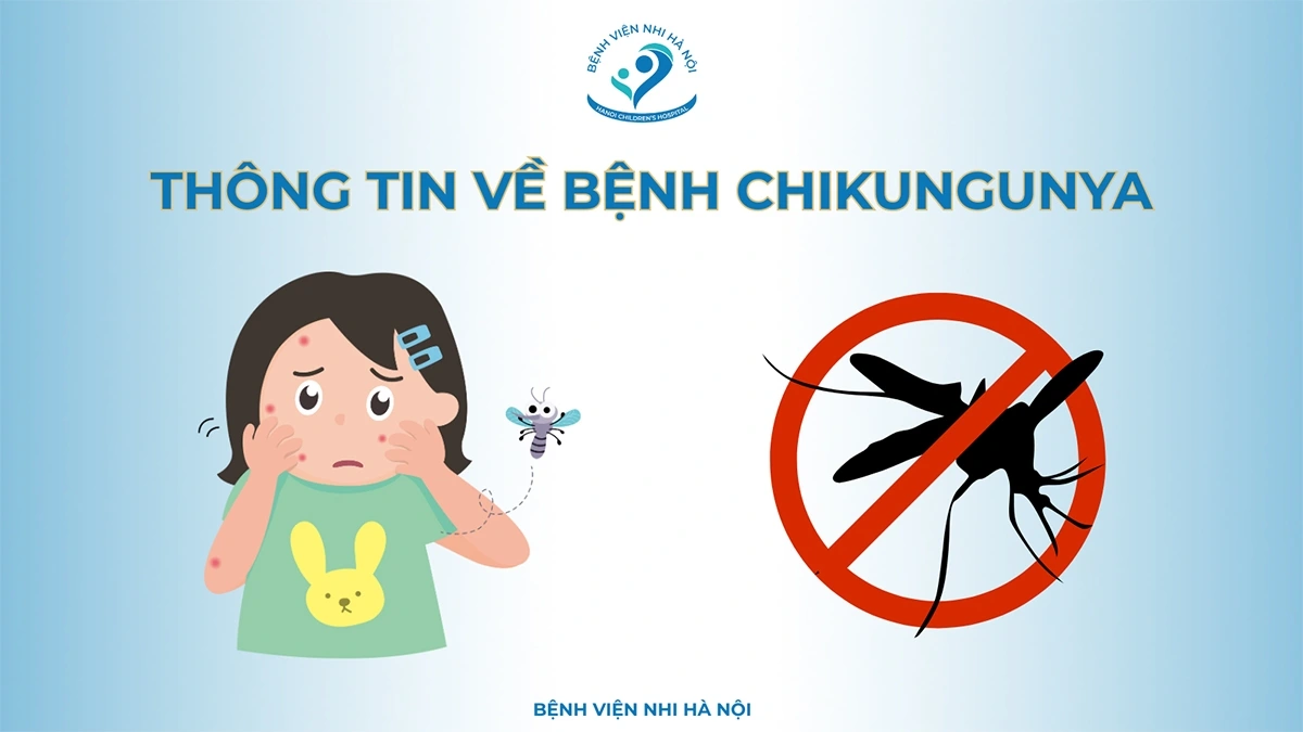 Bệnh Chikungunya là bệnh truyền nhiễm do vi rút Chikungunya (CHIKV) gây ra