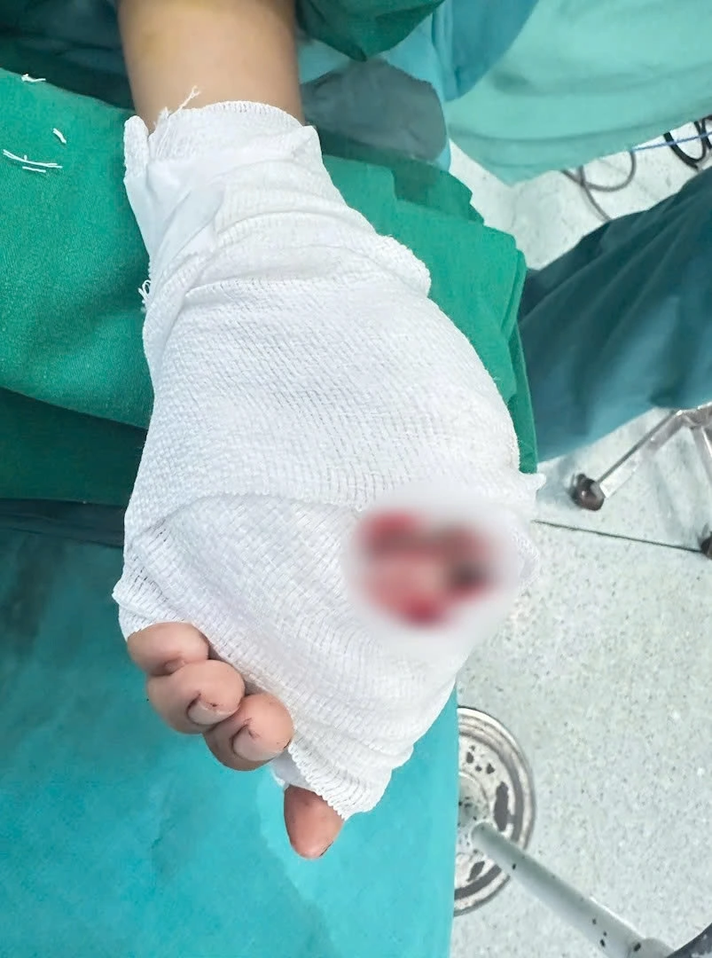 Trẻ được đưa kịp "giờ vàng" nên có thể phẫu thuật nối lại (Ảnh BV cung cấp)