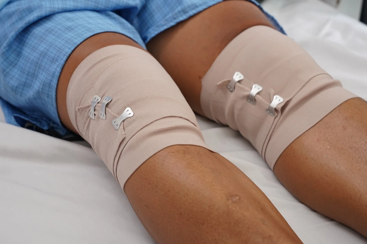 Bệnh nhân phục hồi, có thể gập gối bình thường (Ảnh Bệnh viện Thống Nhất)