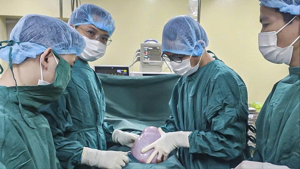 Các bác sĩ Bệnh viện Đa khoa tỉnh Quảng Ngãi 2 phẫu thuật, cắt bỏ khối u buồng trứng nặng 5,5 kg cho bệnh nhân nữ.
