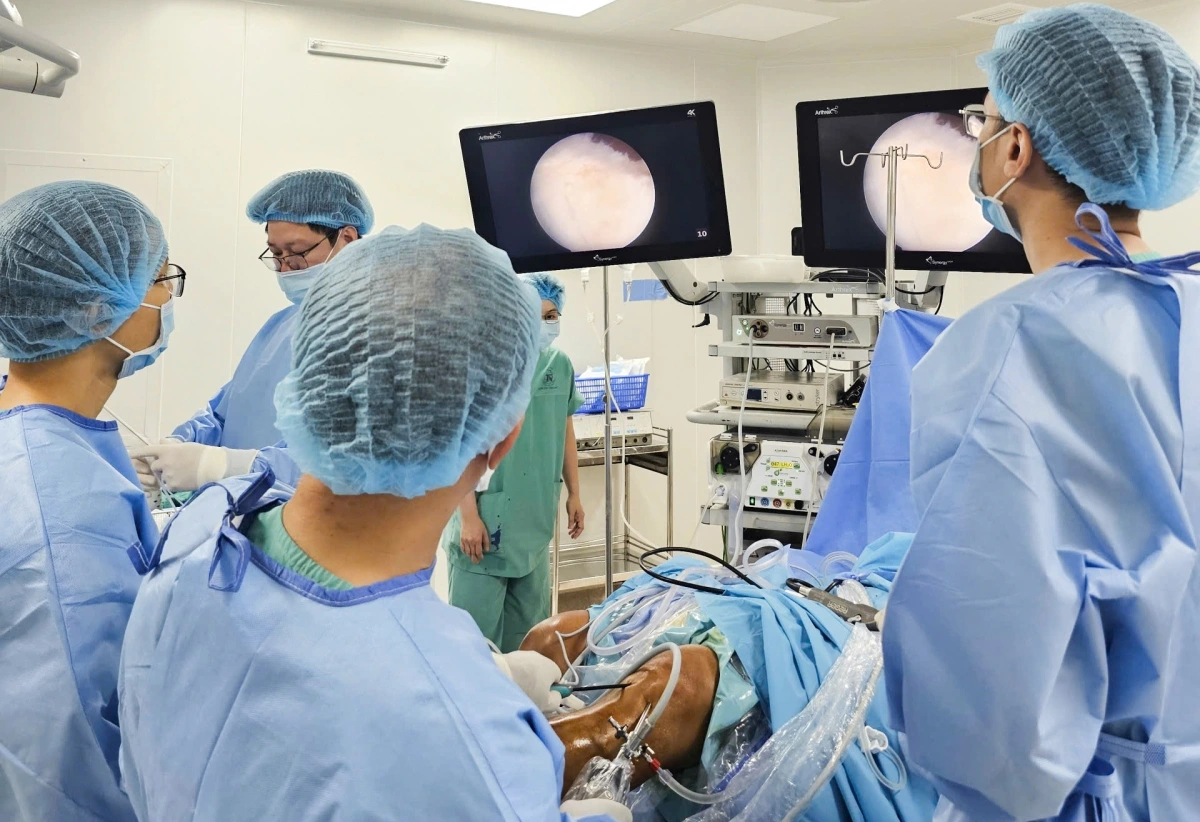 Các bác sĩ phẫu thuật cho khớp gối bị thoái hóa (Ảnh Bệnh viện Thống Nhất)