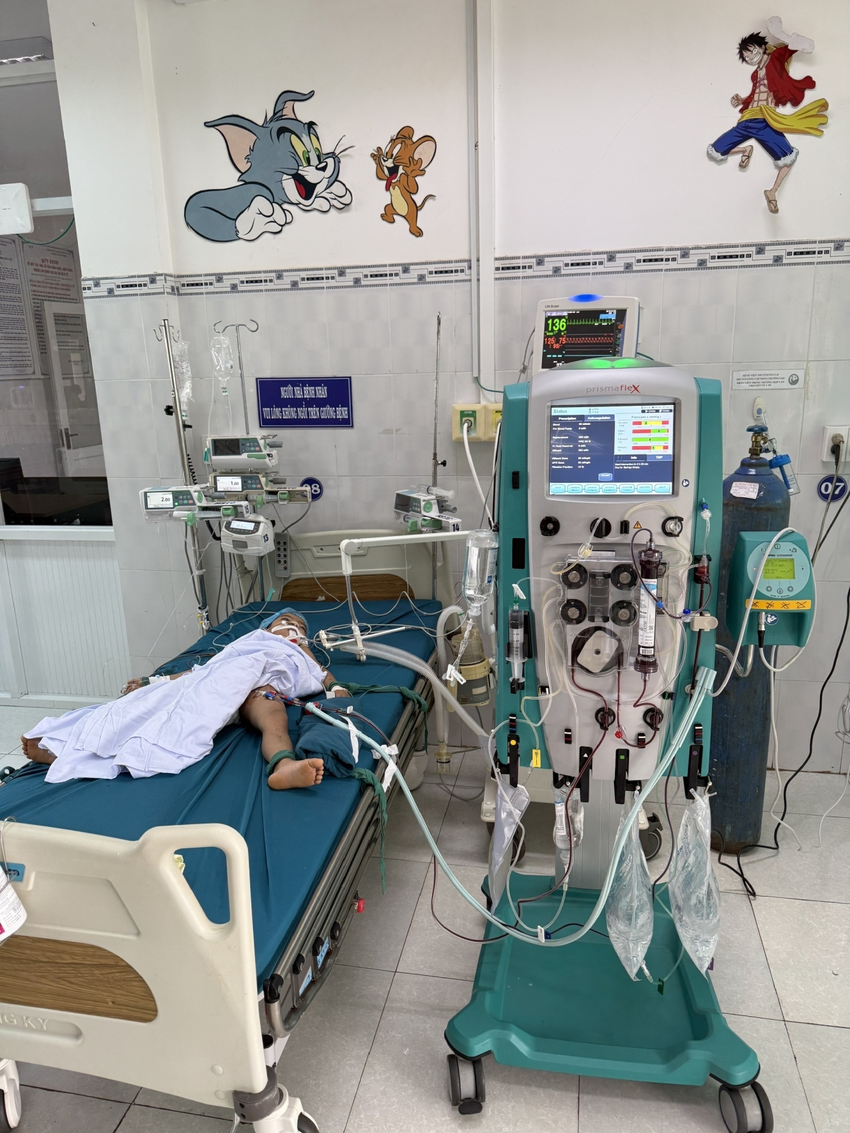 Cháu K.T đang được lọc máu trong tình trạng sốc phản vệ cấp độ 3. (ảnh: Bệnh viện Nhi Gia Lai)