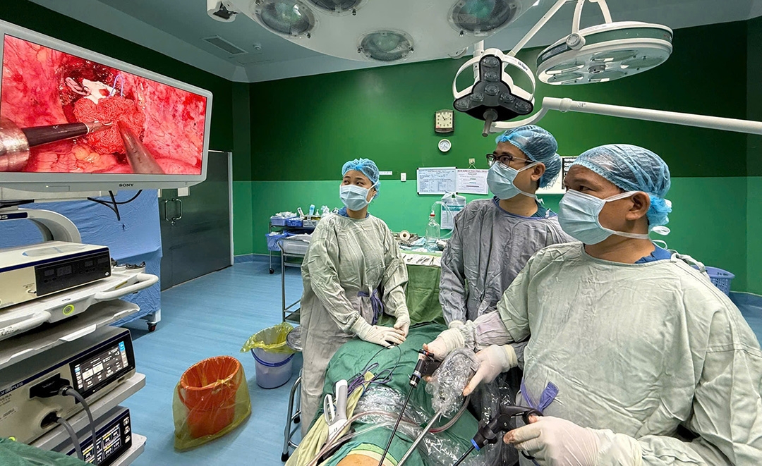 Ê kíp phẫu thuật nội soi để cắt bỏ khối u