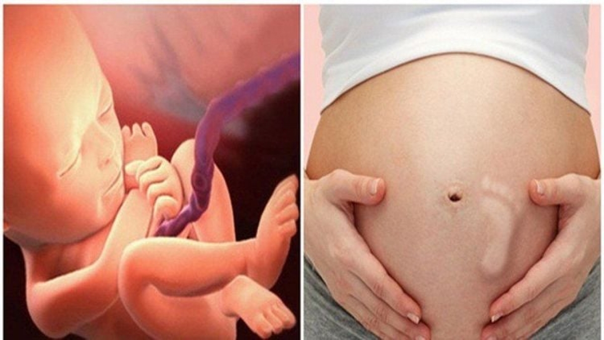 Theo dõi thường xuyên cử động của thai nhi giúp mẹ biết được sức khỏe của bé. Ảnh: Internet