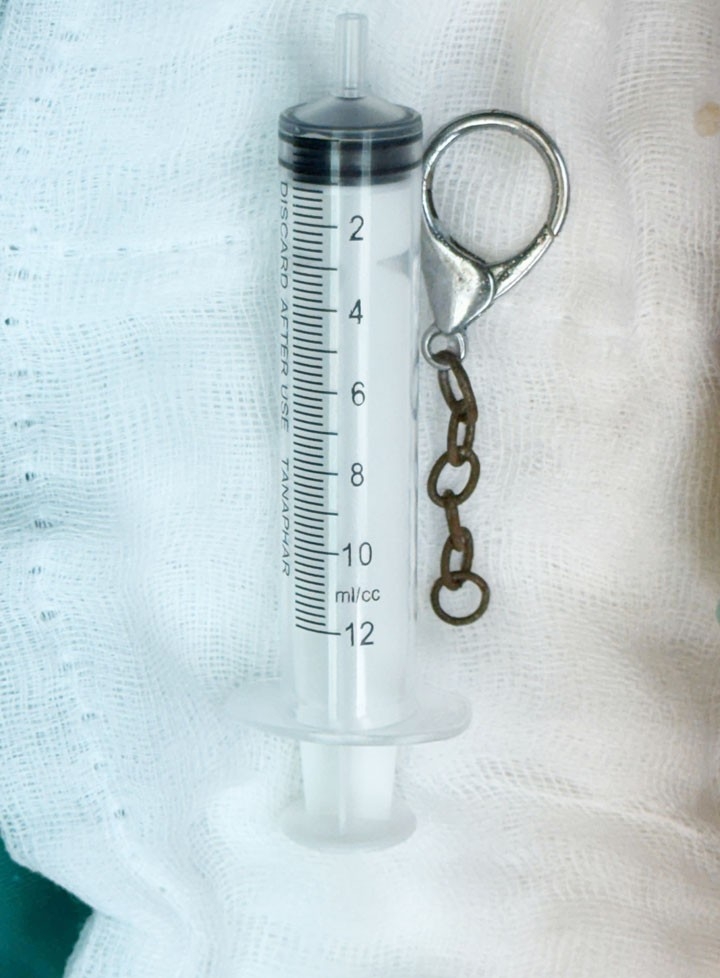 Dị vật móc khóa được lấy ra ngoài