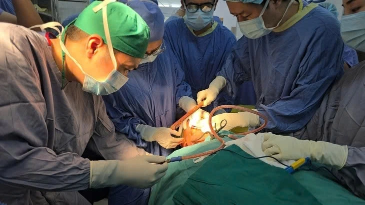 Các bác sĩ Bệnh viện Hữu nghị Việt Đức phẫu thuật lấy thanh sắt đâm xuyên qua đầu cho nam sinh 16 tuổi - Ảnh: BVCC