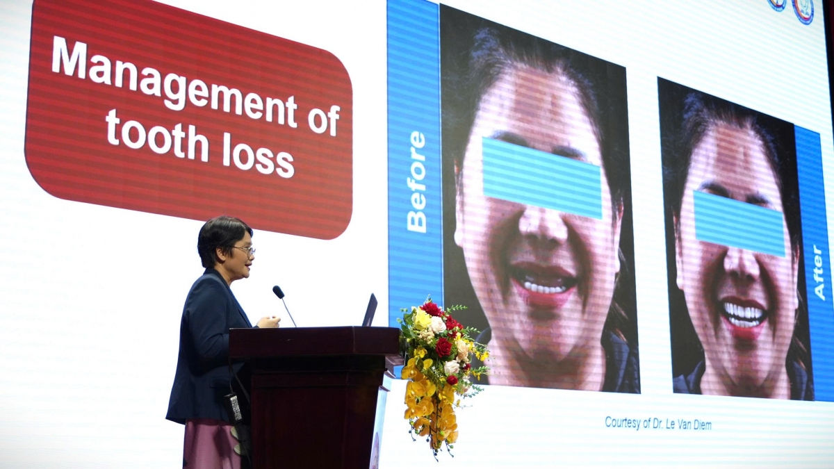 Phó Trưởng Khoa – Trưởng Bộ môn Bệnh học miệng – Nha chu (Khoa Răng Hàm Mặt, Trường Đại học Y Dược Cần Thơ) PGS.TS. Đỗ Thị Thảo cho thấy năng lực nghiên cứu và sáng tạo của đội ngũ giảng viên Việt Nam trong xu thế chuyển đổi số y tế toàn cầu