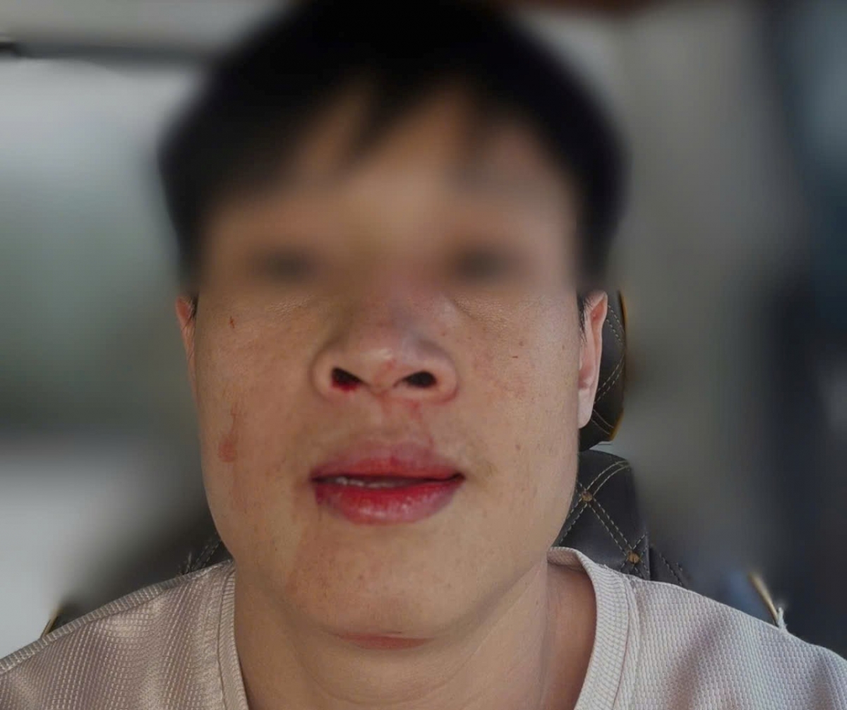 tai_xe_bi_danh_giua_duong.jpg