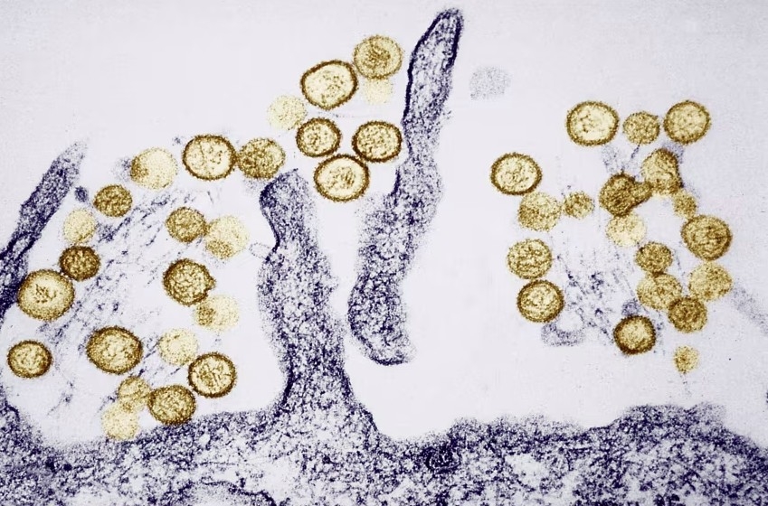 hantavirus.jpg