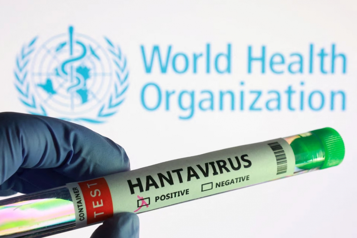hantavirus_2.jpg