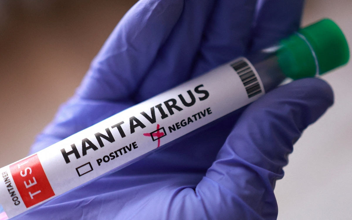 virus Hanta, ong xet nghiem virus, duong tinh am tinh -reu.jpg