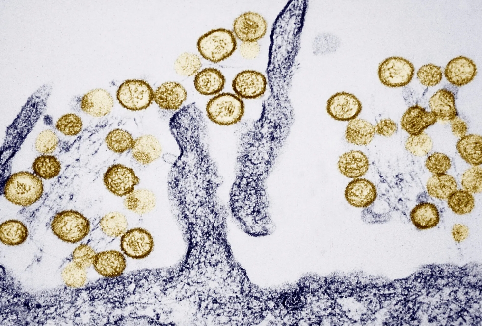 virus-hanta.png
