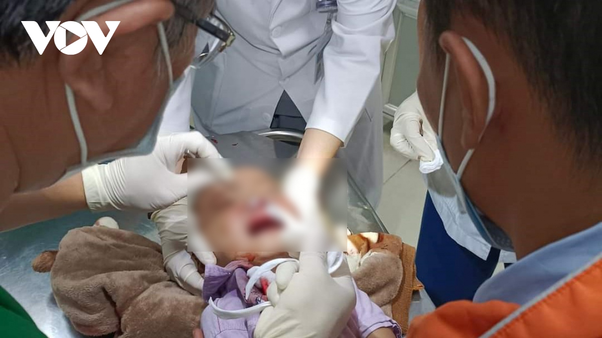 xac minh thong tin canh sat giao thong lam em be 3 tuoi bi trong thuong hinh anh 1