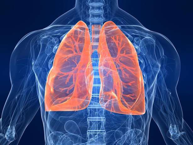 10 trieu chung cua benh lupus ban do  hinh 7