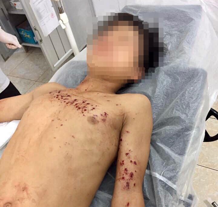 dap nat ban tay vi thoi quen vua sac vua dung dien thoai hinh 1