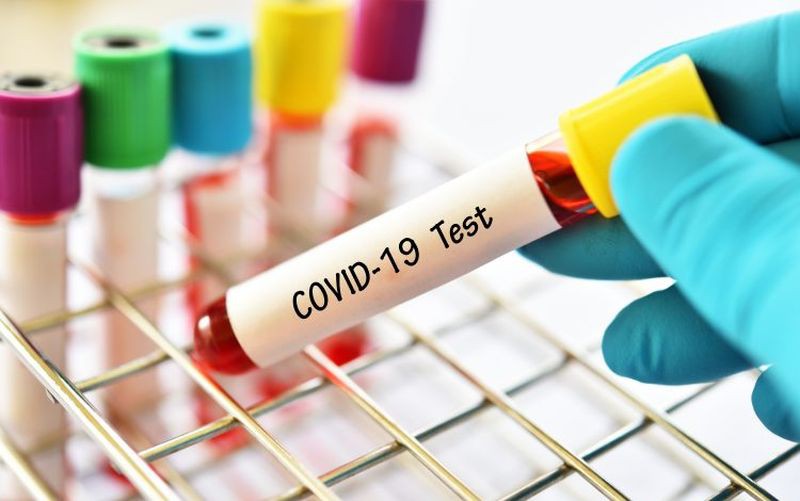 anh nhap khau 3,5 trieu bo kit xet nghiem sars-cov-2 hinh 1