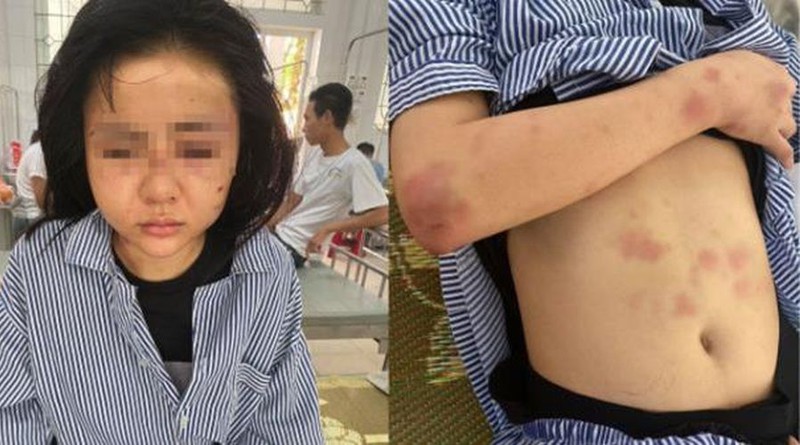 cai ket buon cua ke cuong yeu danh dap ban gai suot 2 tieng hinh 1