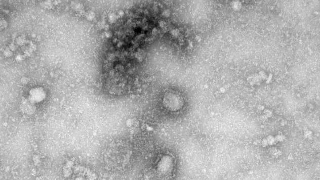 so nguoi tu vong vi virus corona tai trung quoc da vuot sars hinh 1