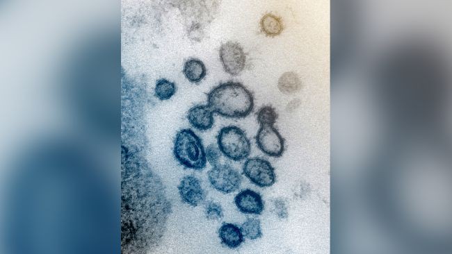 diem danh nhung virus dang so tren trai dat hinh 3
