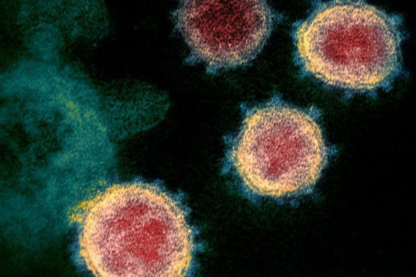 vi sao truy tim nguon goc virus sars-cov-2 giong nhu "mo kim day be"? hinh 1