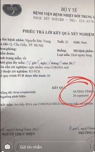 xuat hien phieu xet nghiem gia co ket qua duong tinh virus corona hinh 1
