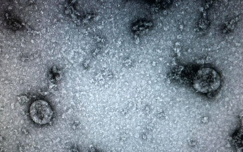 viet nam nuoi cay va phan lap thanh cong virus corona moi (ncov)  hinh 1