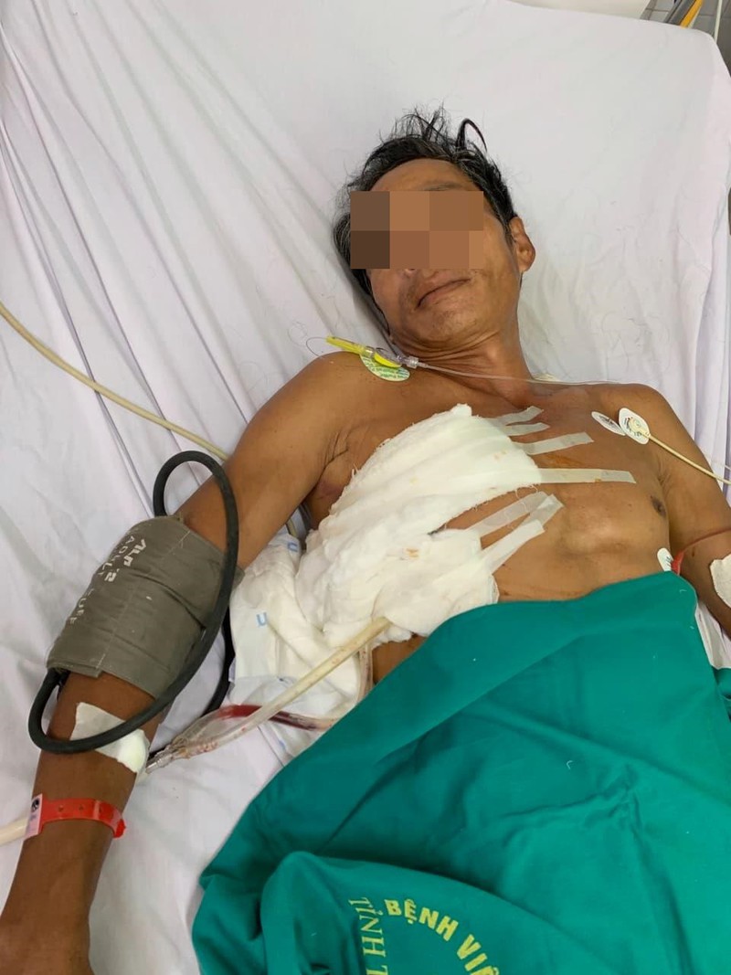90 phut can nao, cuu song benh nhan bi xa beng dam xuyen nguc hinh 2