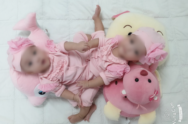 ​100 nhan vien y te tham gia ca mo tach dinh song sinh hiem gap  hinh 1