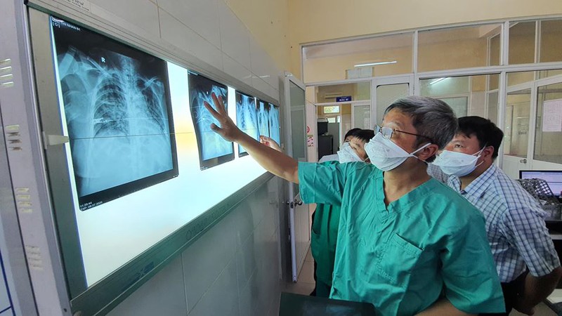 2 ca mac covid-19 tai benh vien tu hue da co xet nghiem am tinh hinh 1