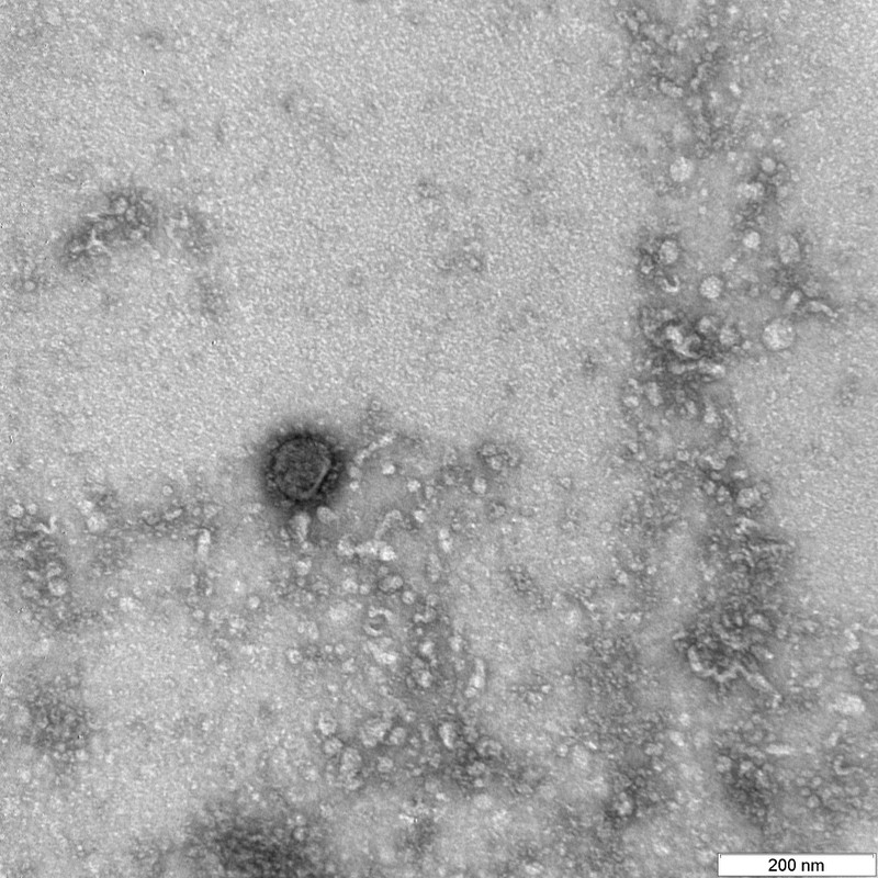 cac nha khoa hoc nga da giai ma duoc bo gen cua virus sars-cov-2  hinh 1