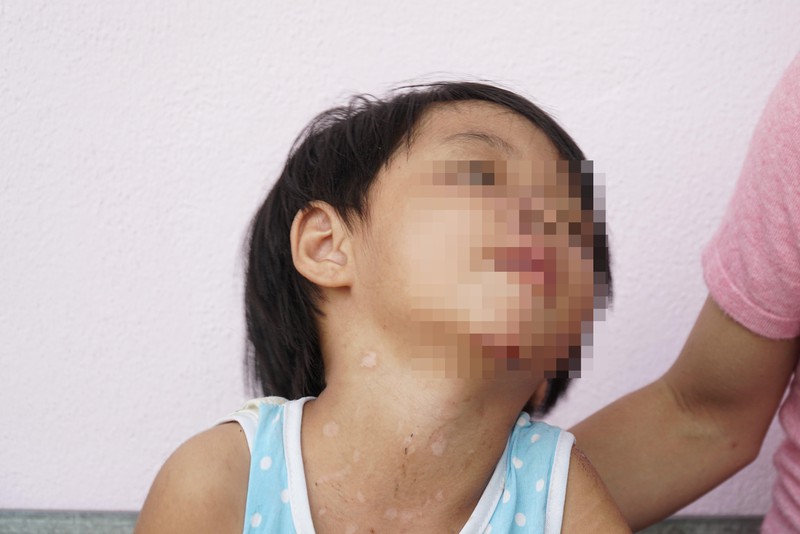 be gai 4 tuoi bi cha duong bao hanh da man o tay ninh hinh 2