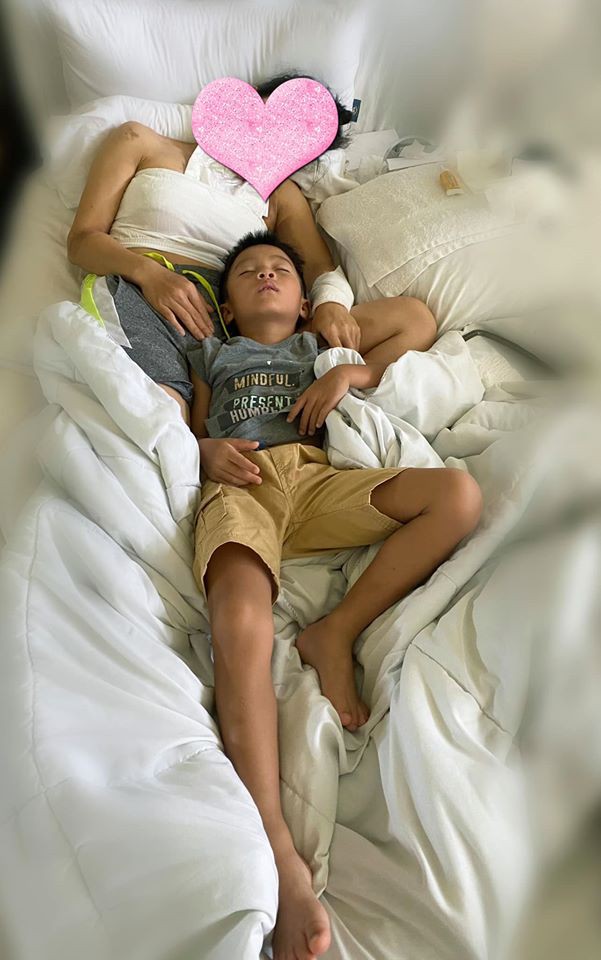 hong ngoc chia se hinh anh dau tien sau 1 tuan bi bong vi no noi xong hinh 1
