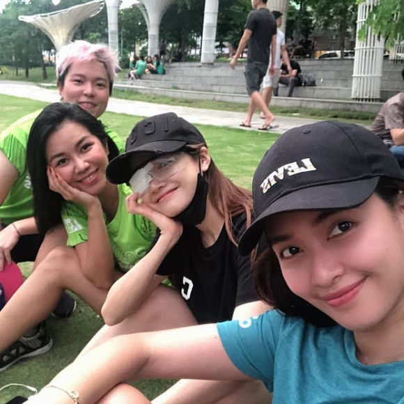 chuyen showbiz: nha phuong bi bang kin 1 ben mat khien fan lo lang hinh 1