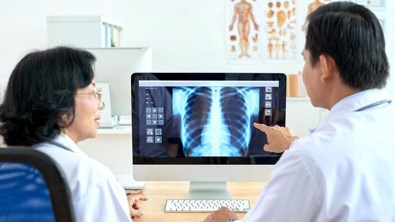 trien khai giai phap ai - vindr trong chan doan hinh anh y te hinh 1