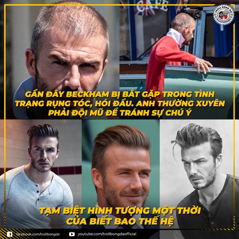 biem hoa 24h: "nam than" david beckham xuong sac khien nhm ngo ngang hinh 1