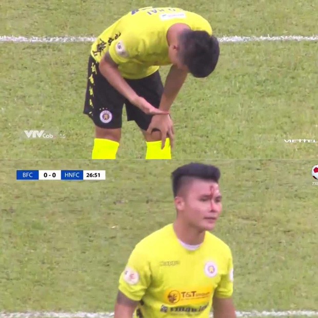 quang hai do mau, thi dau nhu chien binh giua "con bao" scandal hinh 3