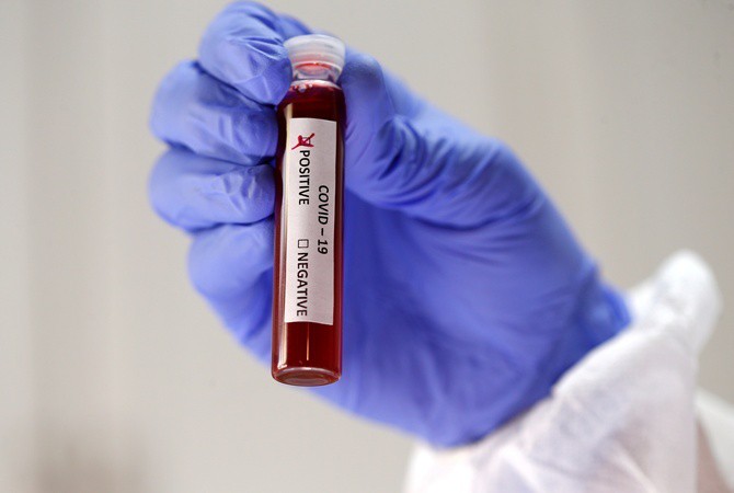 ukraine co gan 800 truong hop nhiem virus sars-cov-2 hinh 1