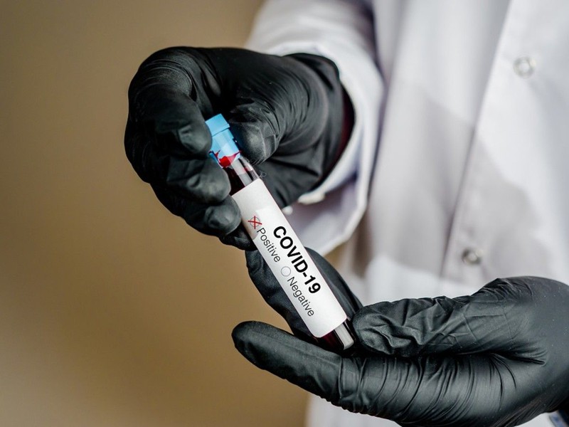 phap dung chloroquine de tri covid-19 khi so ca tu vong tang ky luc hinh 1
