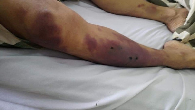 khoi to bi can vu pham nhan chet trong nha tam giu cong an chau duc hinh 1
