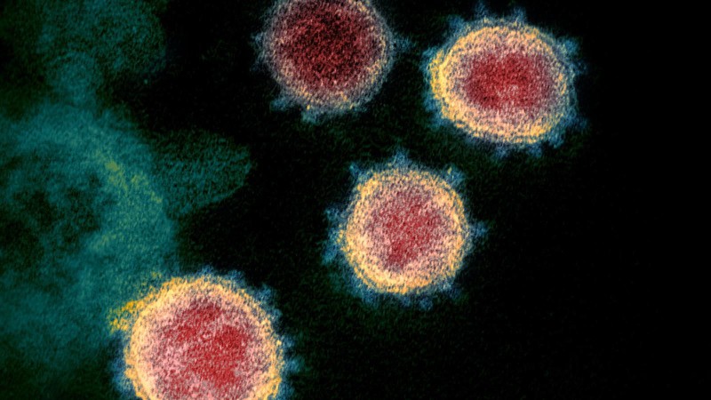who canh bao virus sars cov-2 co the khong bao gio bien mat hinh 1