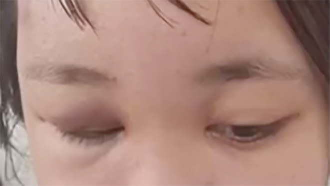 thong tin tiep vu nu sinh thpt bi danh hoi dong ngay giua tp ha long hinh 3